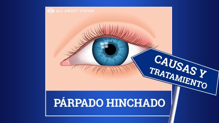 10 Consejos Efectivos sobre Cómo Reducir la Hinchazón de un Ojo Rápidamente