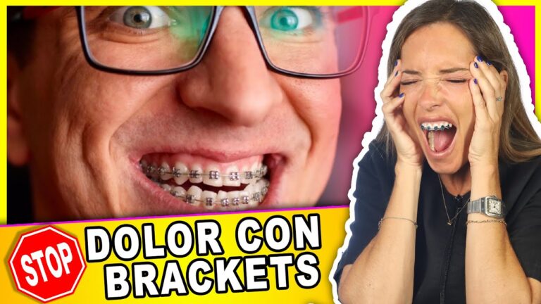 5 Estrategias Efectivas para Aliviar el Dolor de los Brackets &#8211; Guía de Alivio