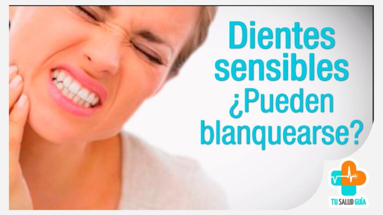 Guía efectiva: Cómo blanquear los dientes sensibles sin dañar tu esmalte