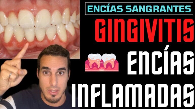 Guía paso a paso para curar la gingivitis eficazmente en casa