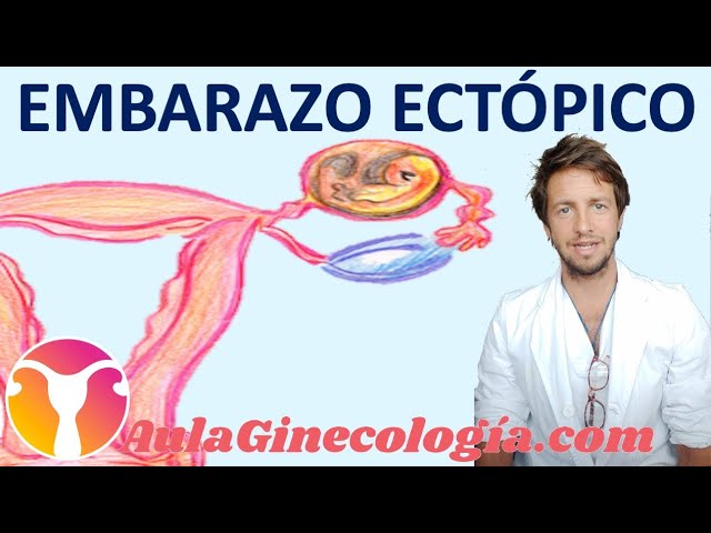 Identifica las Diferencias: Aborto vs. Embarazo Ectópico &#8211; Guía Explicativa