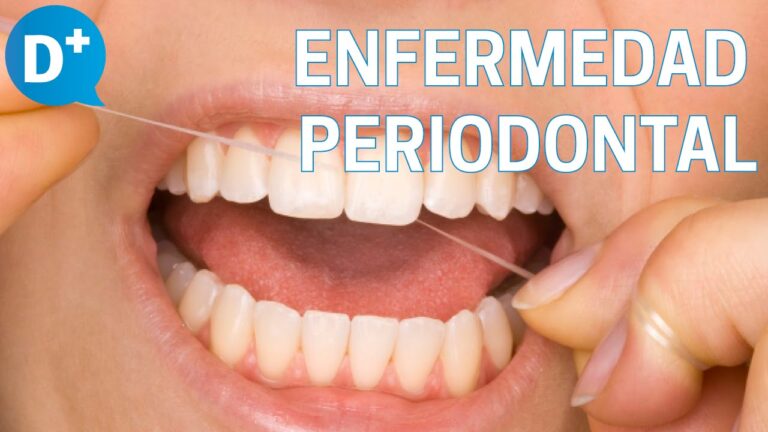 Guía Definitiva: Cómo Eliminar la Placa Dental y Prevenir la Enfermedad Periodontal