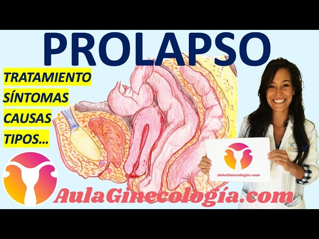 Guía Completa sobre el Prolapso Genital: Síntomas y Signos a Observar