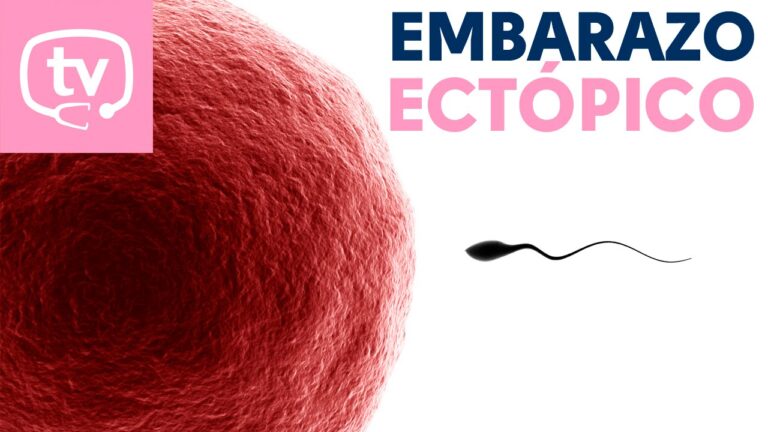 Guía Completa sobre el Embarazo Ectópico: Causas, Síntomas y Tratamiento