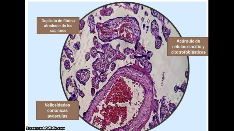 Entendiendo los infartos de la placenta: causas, síntomas y prevención