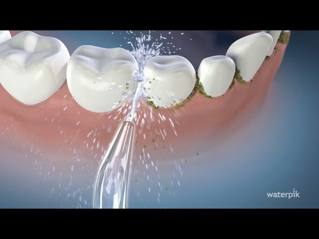 Guía Práctica: Aprende Cómo Usar un Irrigador Dental Waterpik para una Higiene Bucal Perfecta