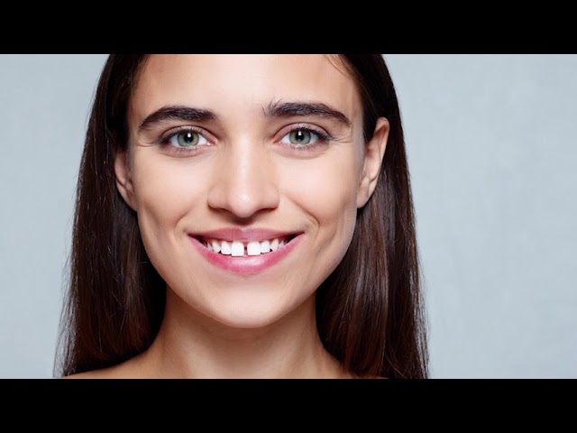 Diastema Dental: Descubre Qué Es y Cómo Afecta Tu Sonrisa