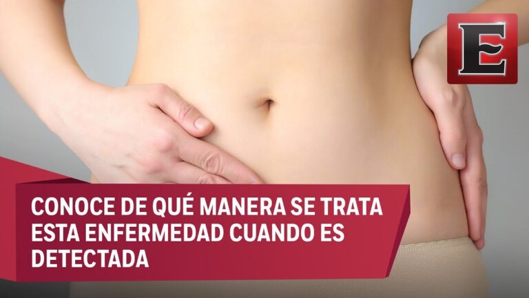 Entendiendo la Endometriosis: Definición, Síntomas y Tratamientos