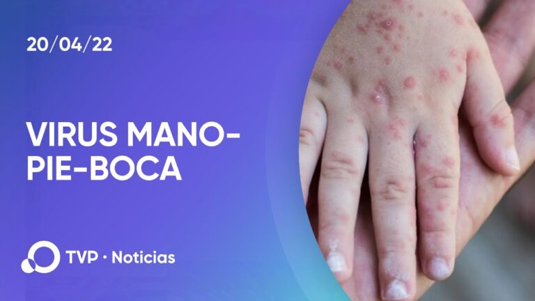 Guía completa sobre la transmisión del virus Manos, Pies y Boca – Prevención y consejos